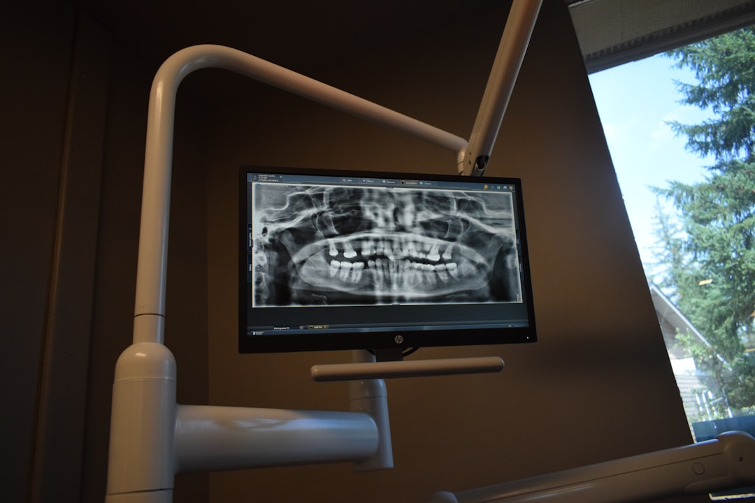 Dental CBCT scan displayed on a clinic monitor used for implant treatment planning