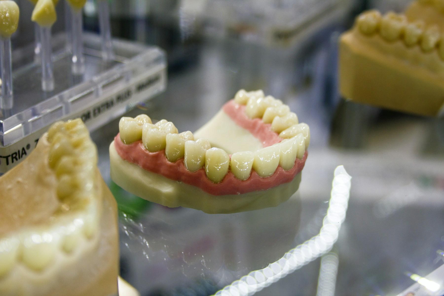 Dental Implants Cost in Berkeley: What to Budget in 2026