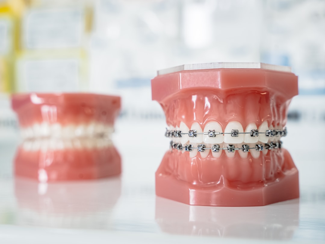 Close-up of metal braces on adult teeth showing brackets and archwire