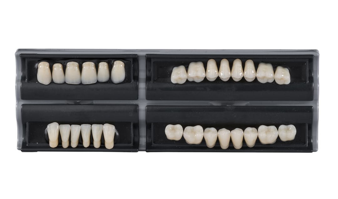 Set of porcelain veneer demonstration models on a clinical surface